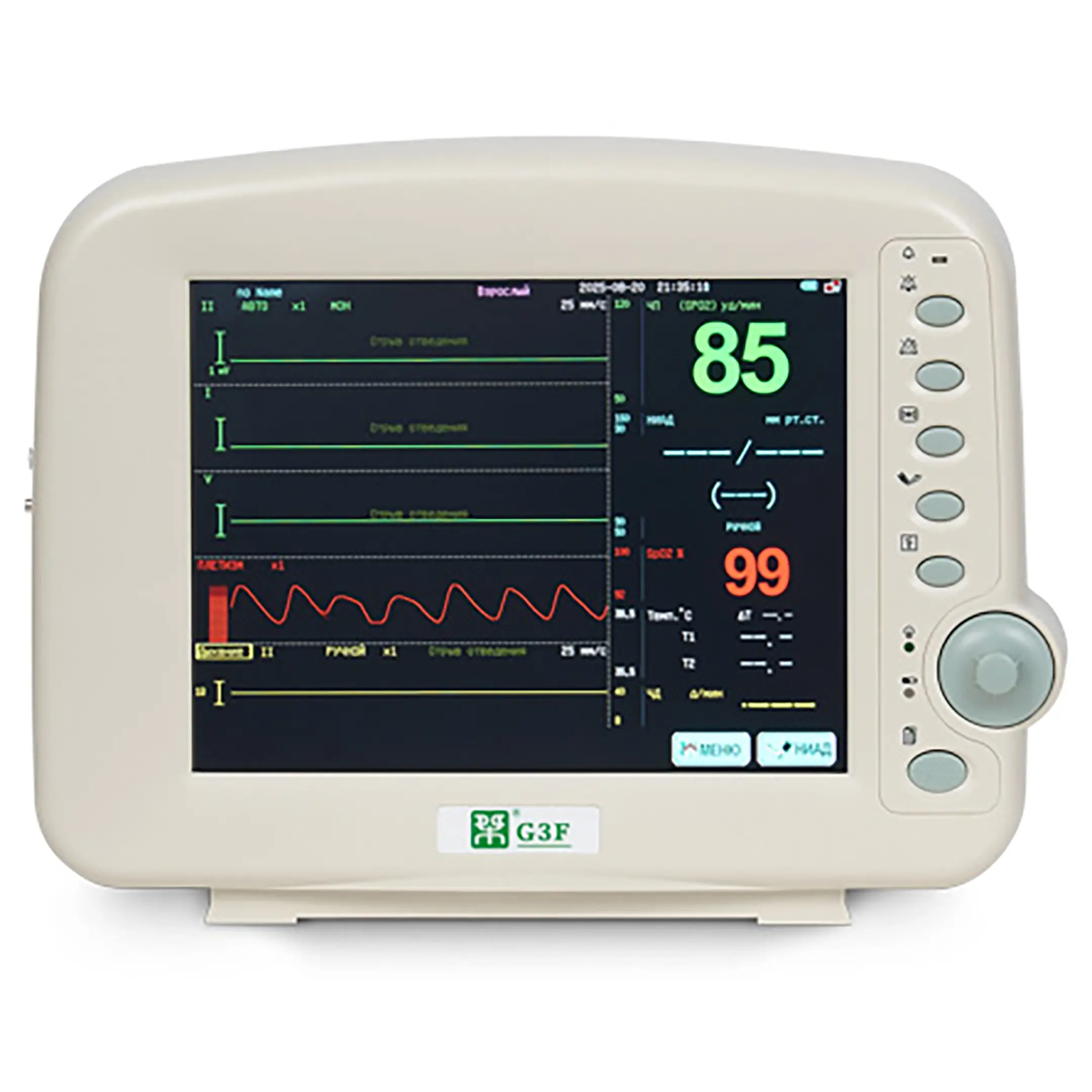 монитор g3f дисплей: 10,4 дюйма